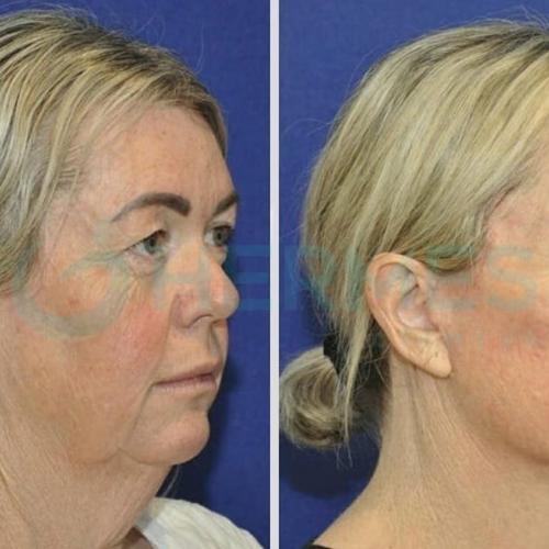 Before after photos of our patients 6